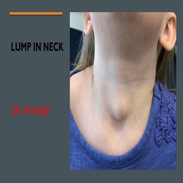 NECK LUMP and sinusitis ggdgdgfdgsdgsdfgsdgf.pptx