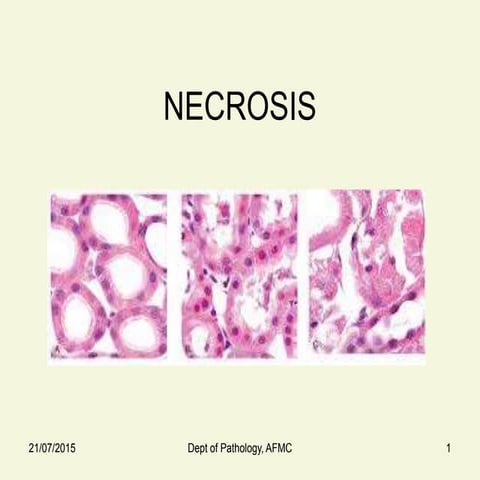 Necrosis and gangrene