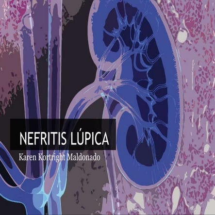 Nefritis lupica