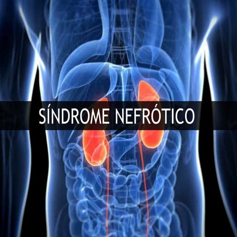 Sindrome Nefrotico
