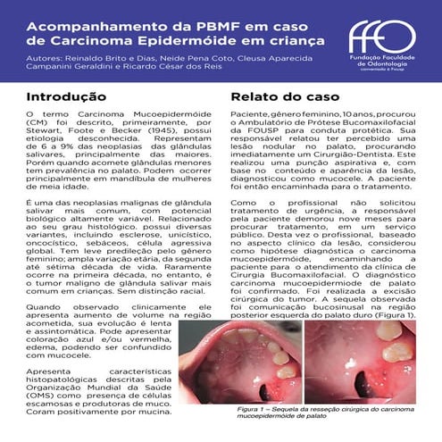 Acompanhamento da PBMF em caso de Carcinoma Epidermóide em criança