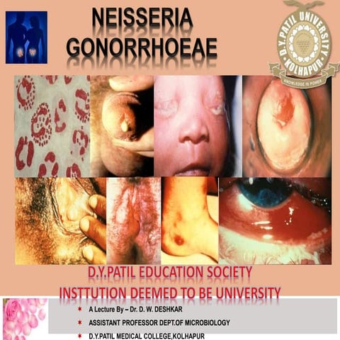Neisseria gonorrhoeae lecture iii term