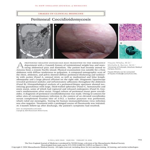 Peritoneal Coccidioidomycosis: Clinical Presentation and Diagnosis | PDF