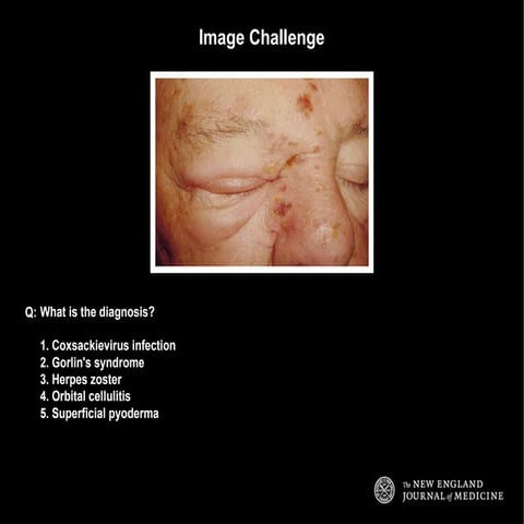 Nejm Medical Image Challenge