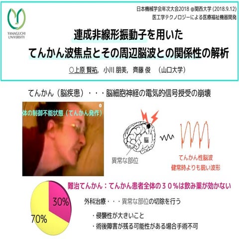 連成非線形振動子を用いたてんかん波焦点とその周辺脳波との関係性の解析（改訂版）