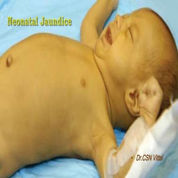 Neonatal jaundice