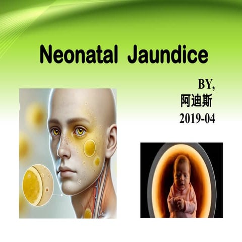 Neonatal Jaundice for the new borns .ppt