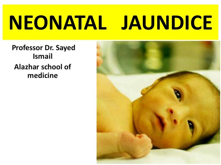 Direct Bilirubin Levels In Newborns Chart