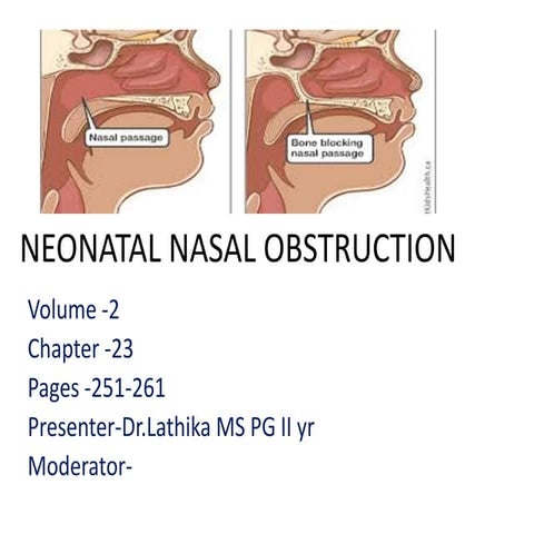 Neonatal nasal obstruction final