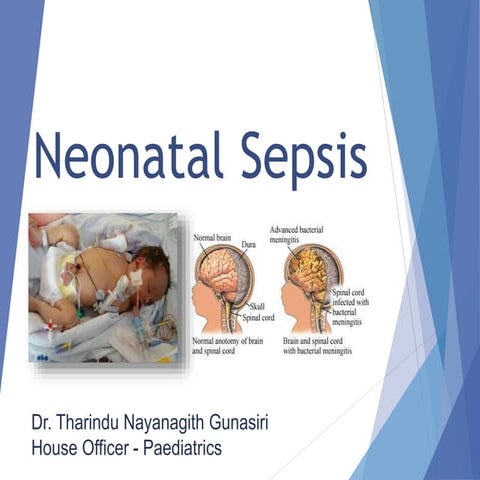 Neonatal sepsis   tharindu n gunasiri