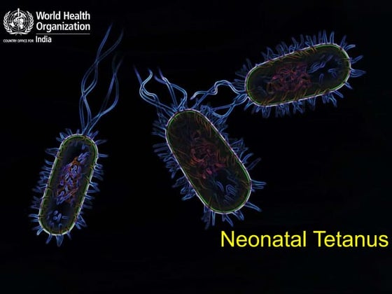 Tetanus | PPT