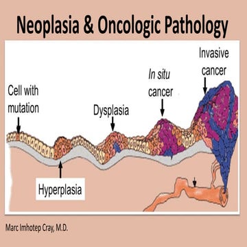 Neoplasia & Oncologic Pathology