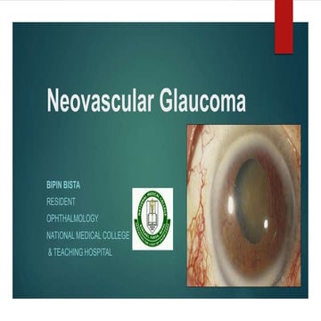 Neovascular glaucoma
