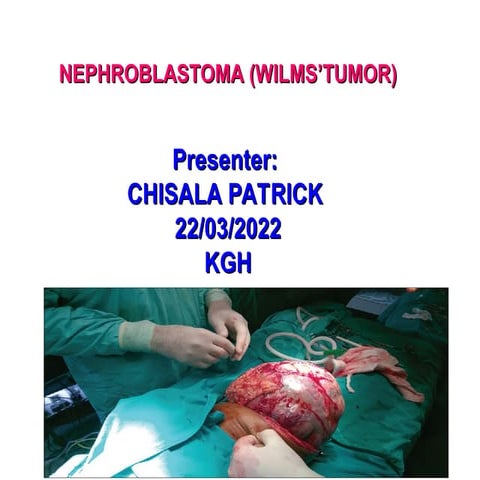 NEPHROBLASTOMA (WILMS’TUMOR)- DIAGNOSIS AND MANAGEMENT.ppt