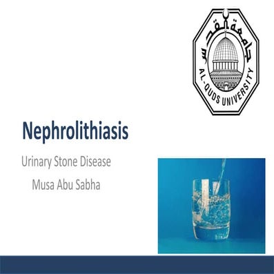 Nephrolithiasis - urinary stones 