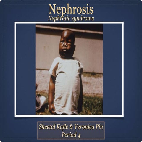Nephrosis period 4 | PPT