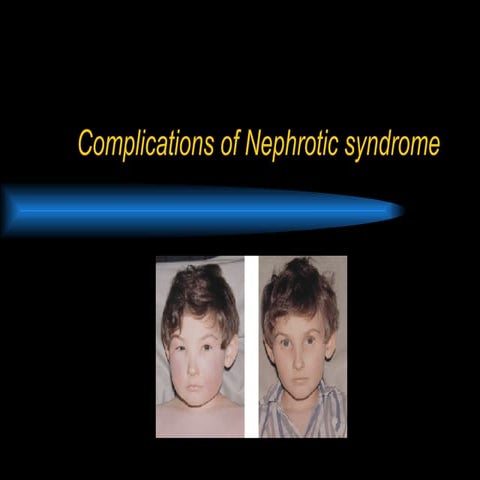 Nephrotic Syndrome