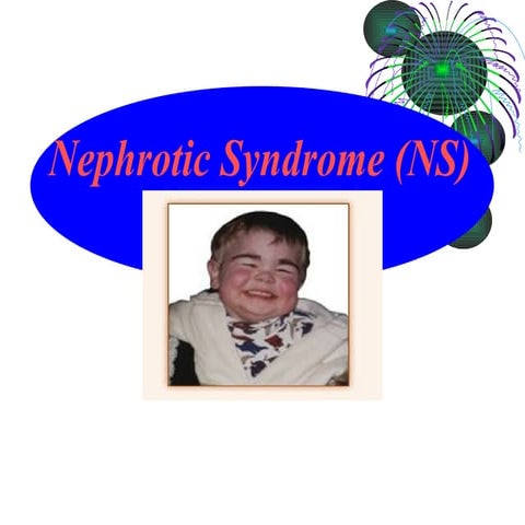 Nephrotic Syndrome