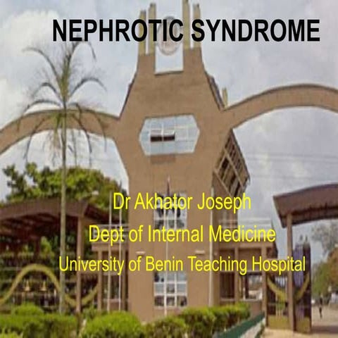 Nephrotic syndrome