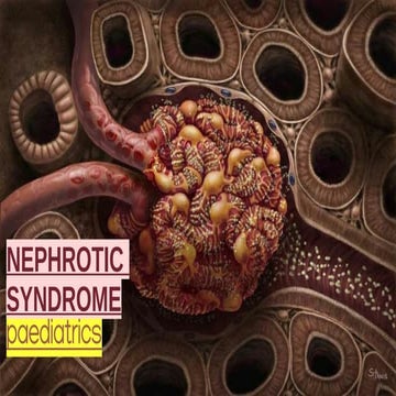 Nephrotic syndrome, Characterized by heavy proteinuria>3.5g/m/day in ...