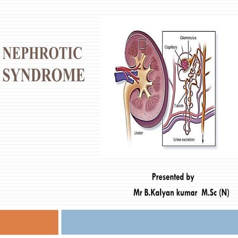 Nephrotic syndrome (Primary glomerulonephrosis)