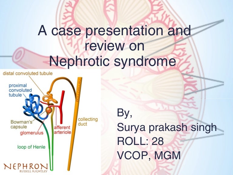 Nephrotic syndrome and a case report