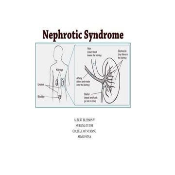 Nepro syndrome