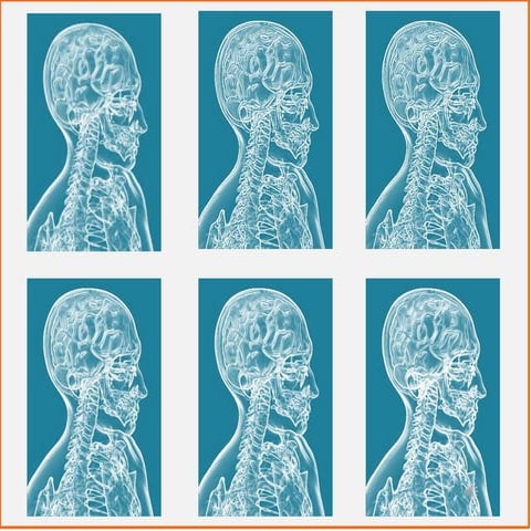 Heterogenes versus homogenes Netzwerk, die Entscheidung ist gefallen!