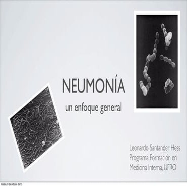 Neumonía
