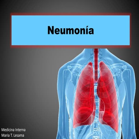 Neumonía