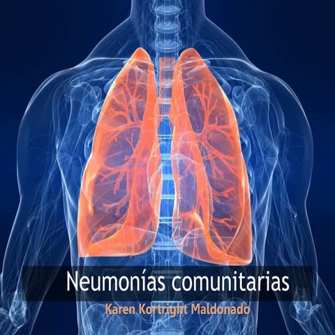 Neumonías comunitarias