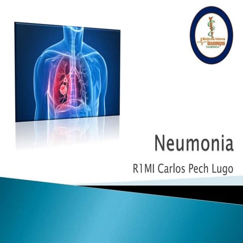 Neumonia