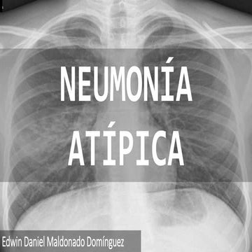 Neumonía Atípica