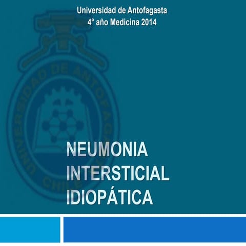 Neumonia intersticial idiopática