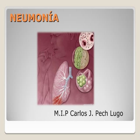 Neumonia en pediatria