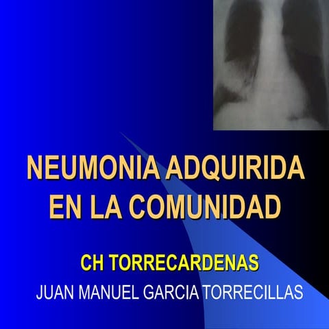Neumonia residentes