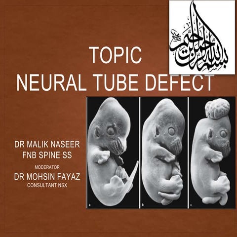 NEURAL TUBE UNER WORK.pptx