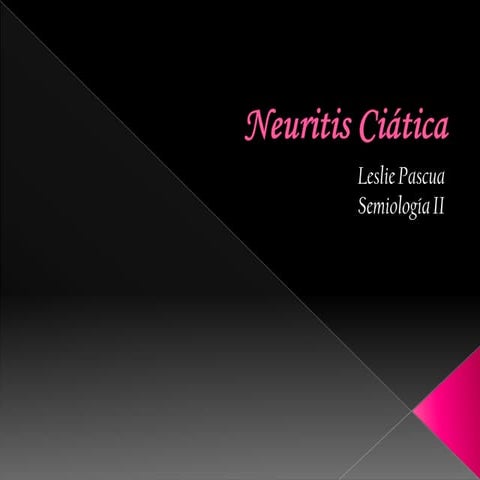 Neuritis Ciática