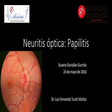 Neuritis óptica