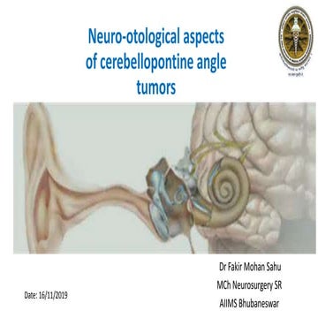 Neuro-otological aspects of Cerebellopontine angle SOL
