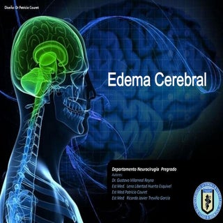 Neurocirugia   edema cerebral
