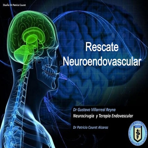 Neurocx   rescate endovascular 3