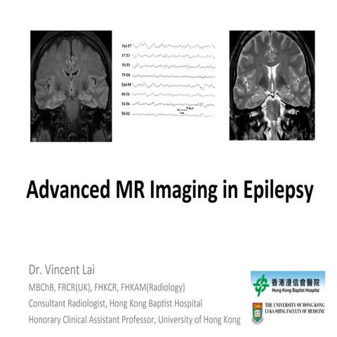 Neurology advanced mr imaging in epilepsy v lai