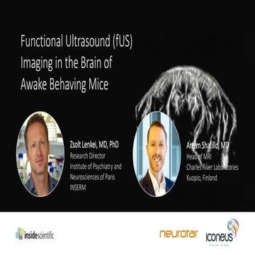 Functional Ultrasound (fUS) Imaging in the Brain of Awake Behaving Mice ...