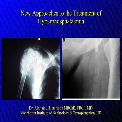 New Approaches To The Treatment Of Hyperphosphataemia (CRF)