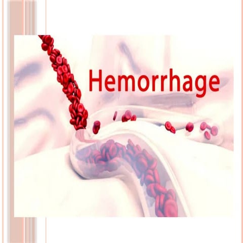 new1.pptx haemorrhage power point presentations