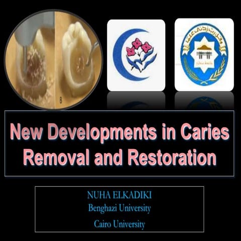 New development in careis removal and restoration
