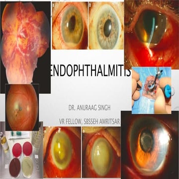  New endophthalmitis