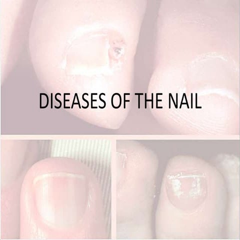 dermatology.nail disorder.(dr.mhamad usif)