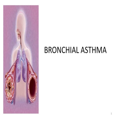 Asthma